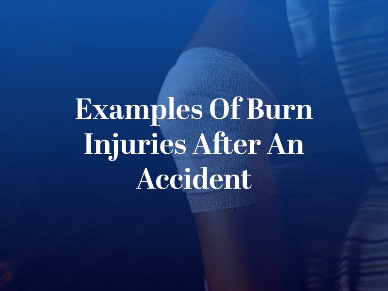 Examples of Burn Injuries After an Accident